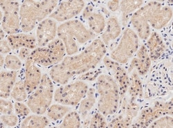 NIPBL Antibody, Novus Biologicals 0.1mg; Unlabeled:Antibodies, Polyclonal